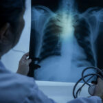 Doctor examining a chest X-ray with a stethoscope in hand