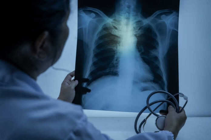 shutterstock_2482877961.jpg Doctor examining a chest X-ray with a stethoscope in hand