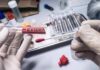 Two Ole Miss Deaths Share A Disturbing Link Gloved hands handling a swab and evidence tube